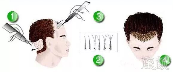 https://img.miyanlife.com/mnt/timg/180601/1153043237-1.jpg