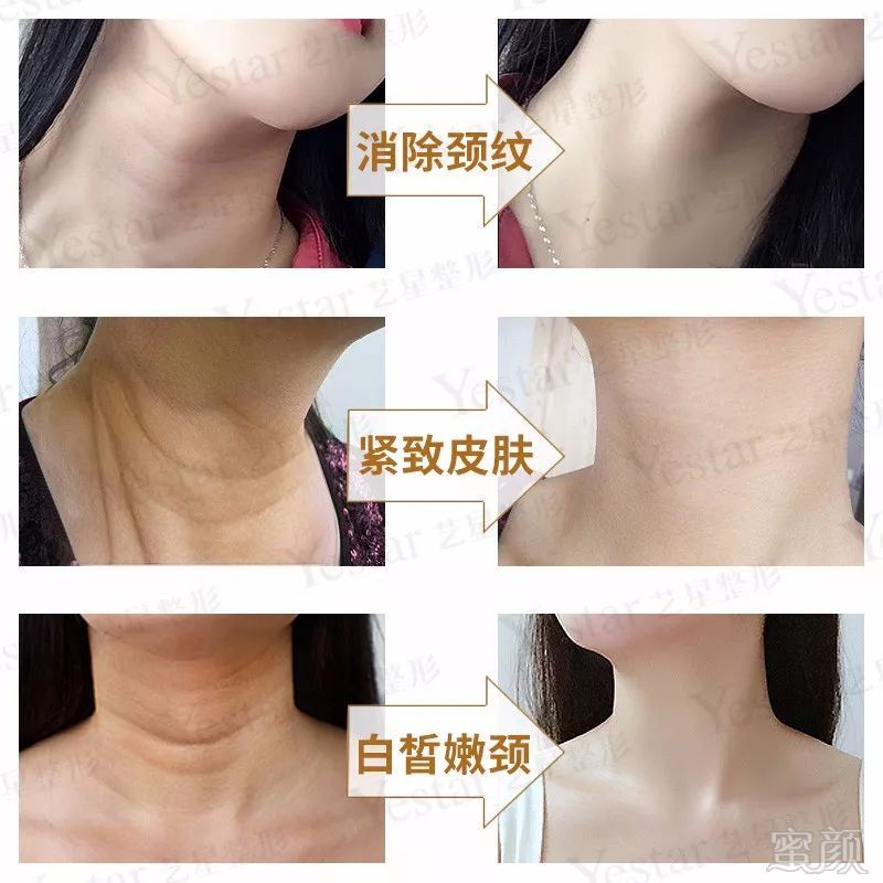 https://img.miyanlife.com/mnt/timg/180601/115T0K21-15.jpg