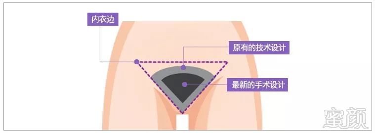 案例图片