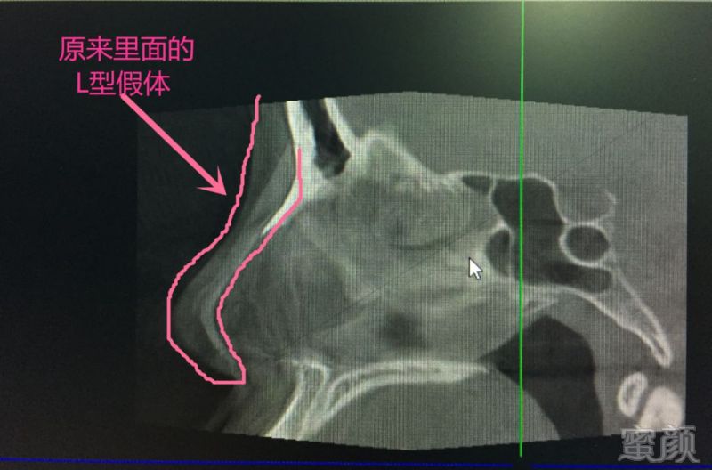 案例图片