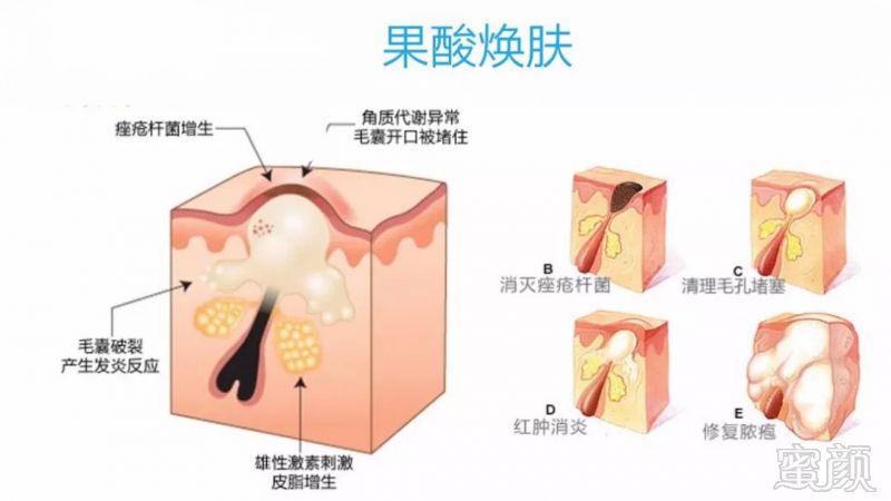 案例图片