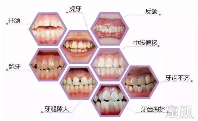 https://img.miyanlife.com/mnt/timg/180601/134S5BG-1.jpg