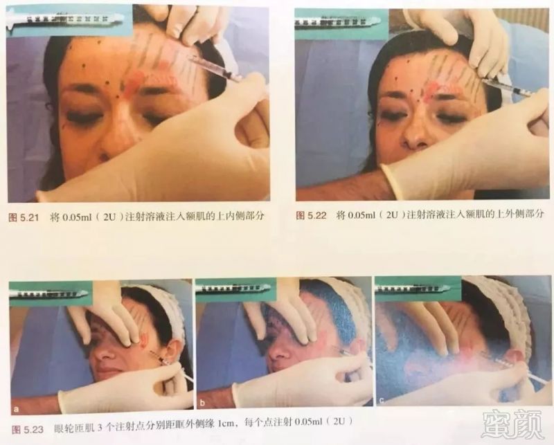 https://img.miyanlife.com/mnt/timg/180602/114S21352-1.jpg