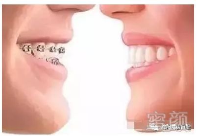 https://img.miyanlife.com/mnt/timg/180602/12013H394-0.jpg