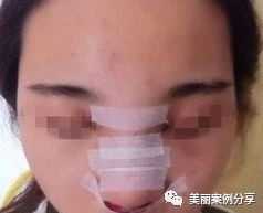 https://img.miyanlife.com/mnt/timg/180602/121J43917-2.jpg
