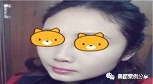 https://img.miyanlife.com/mnt/timg/180602/12205SL8-4.jpg
