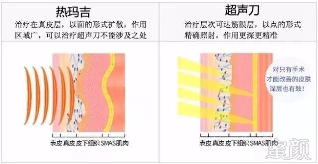 案例图片