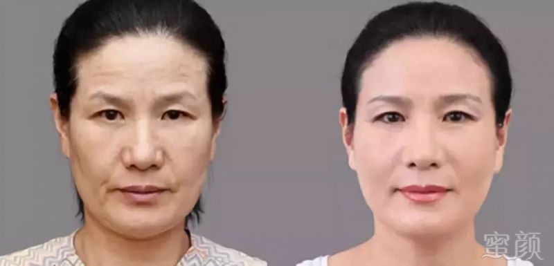 https://img.miyanlife.com/mnt/timg/180602/12562Sb6-0.jpg