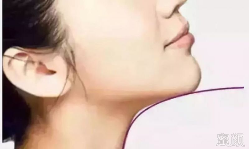 https://img.miyanlife.com/mnt/timg/180603/110611I34-3.jpg