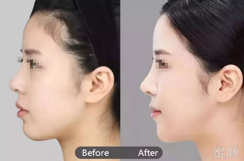 https://img.miyanlife.com/mnt/timg/180603/1106153P4-12.jpg