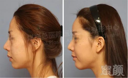 https://img.miyanlife.com/mnt/timg/180603/11320V442-6.jpg