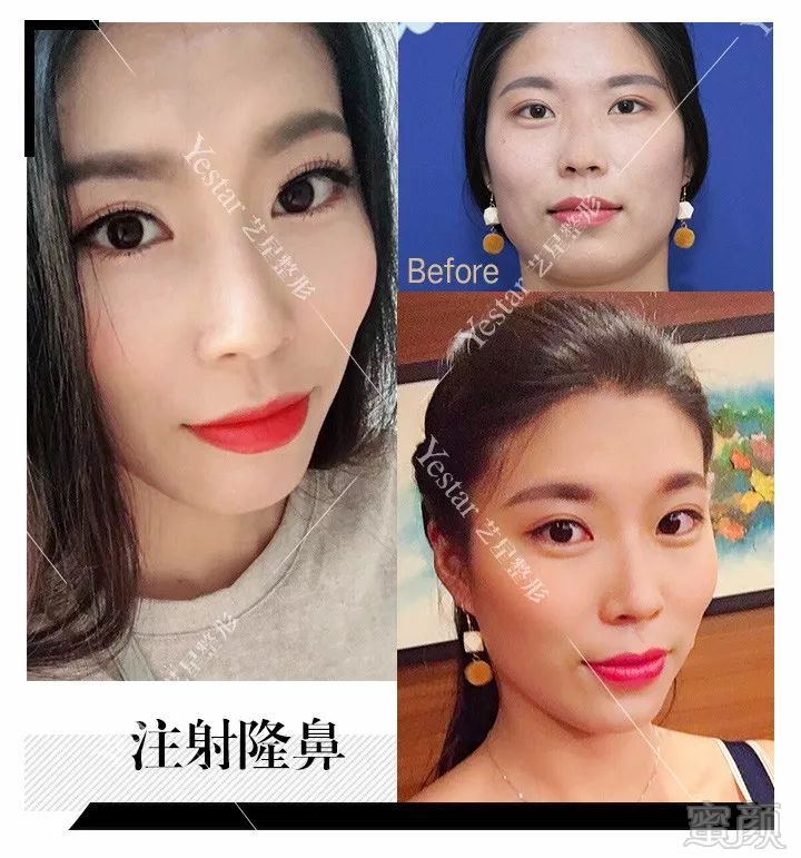 https://img.miyanlife.com/mnt/timg/180603/113P62N3-5.jpg