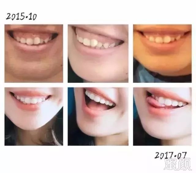 https://img.miyanlife.com/mnt/timg/180603/113U92c2-5.jpg