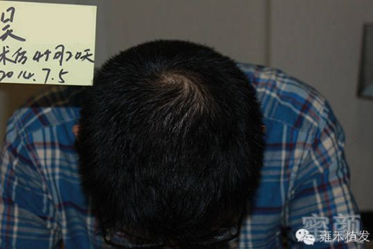 https://img.miyanlife.com/mnt/timg/180603/113ZT258-6.jpg