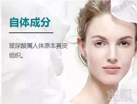 https://img.miyanlife.com/mnt/timg/180603/11422T210-15.jpg