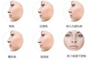 https://img.miyanlife.com/mnt/timg/180603/1149223050-10.jpg