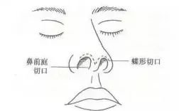 https://img.miyanlife.com/mnt/timg/180603/114922JM-9.jpg
