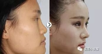 https://img.miyanlife.com/mnt/timg/180604/11332VK4-0.jpg