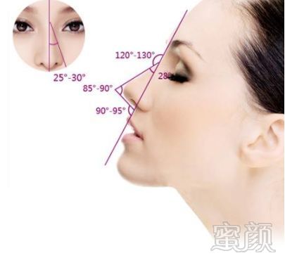 https://img.miyanlife.com/mnt/timg/180604/11515B1E-0.jpg
