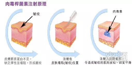 案例图片