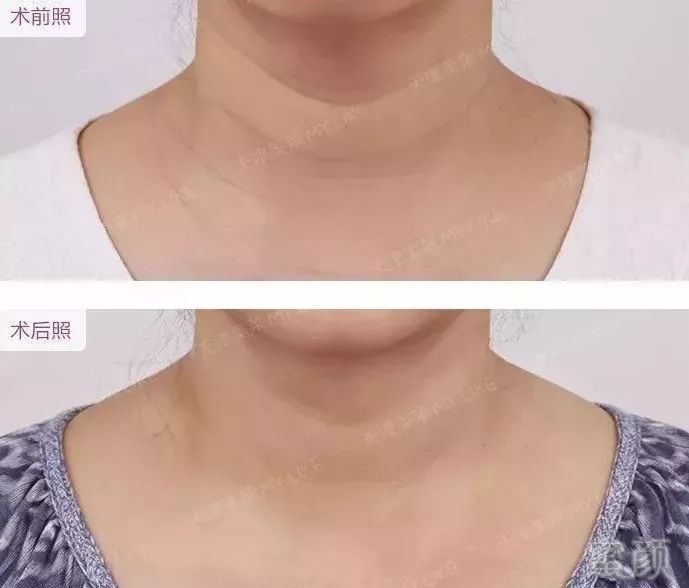 https://img.miyanlife.com/mnt/timg/180604/1159416214-0.jpg