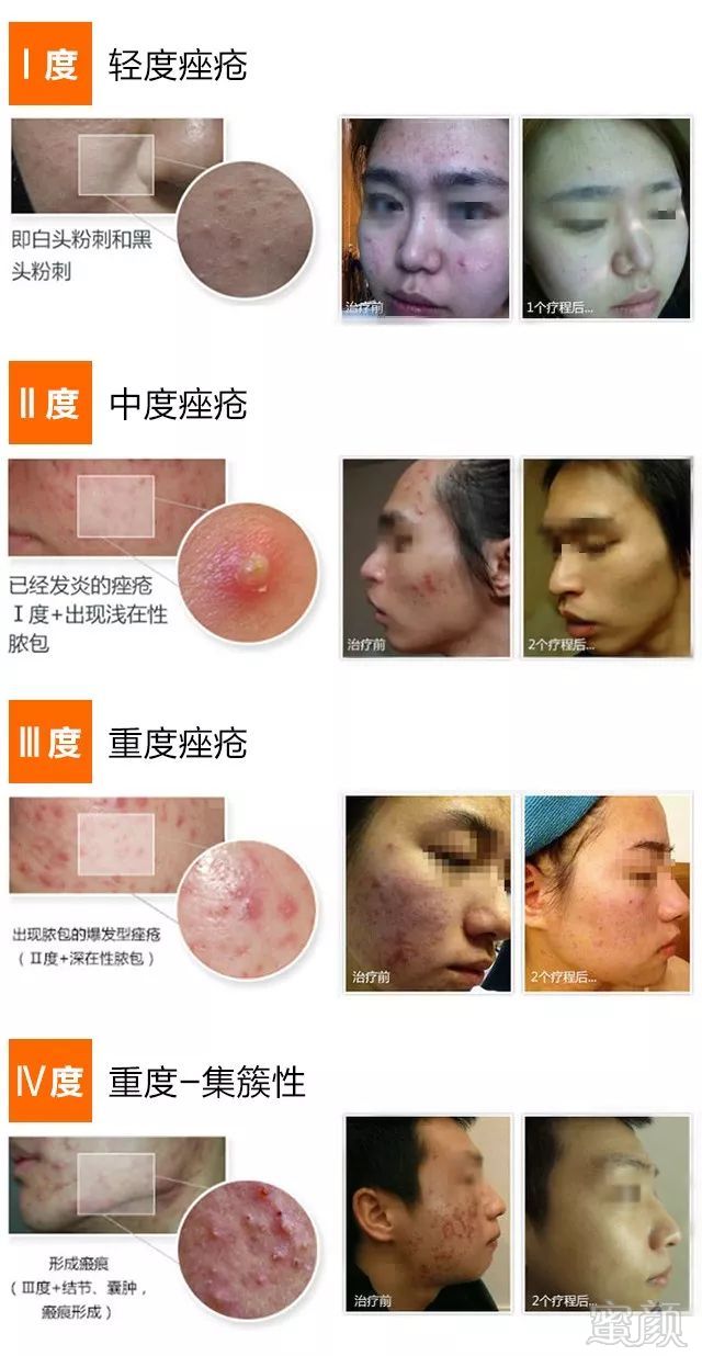 https://img.miyanlife.com/mnt/timg/180604/115HTS7-2.jpg