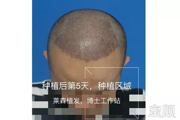 https://img.miyanlife.com/mnt/timg/180604/1205031H8-8.jpg