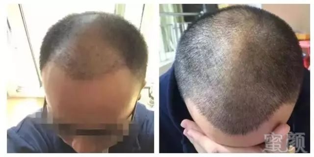 https://img.miyanlife.com/mnt/timg/180604/1205036038-9.jpg