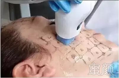 案例图片