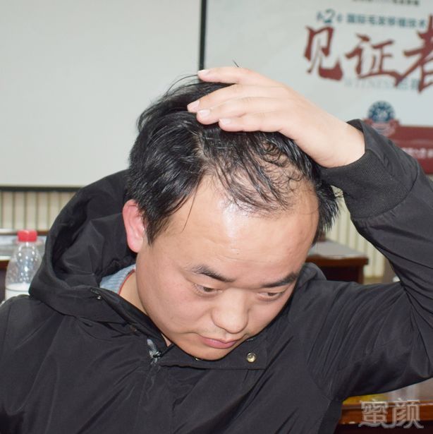 https://img.miyanlife.com/mnt/timg/180604/1223154252-1.jpg