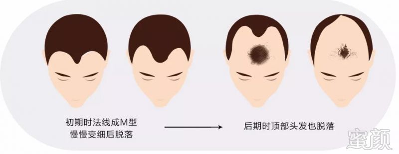 https://img.miyanlife.com/mnt/timg/180604/1223162245-2.jpg