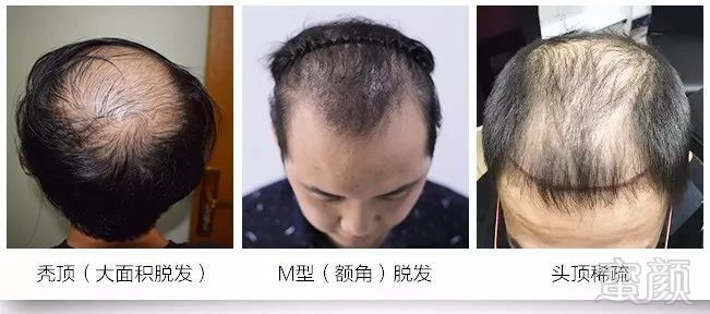 https://img.miyanlife.com/mnt/timg/180604/12231635X-3.jpg
