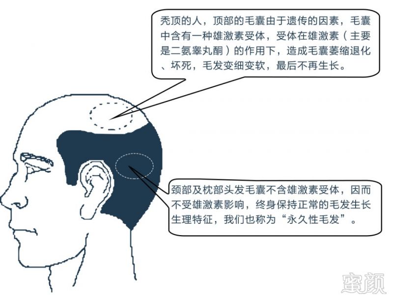 https://img.miyanlife.com/mnt/timg/180604/12231G142-6.jpg