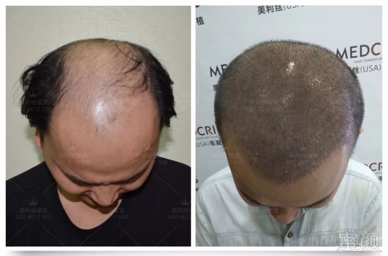 https://img.miyanlife.com/mnt/timg/180604/12231W364-7.jpg