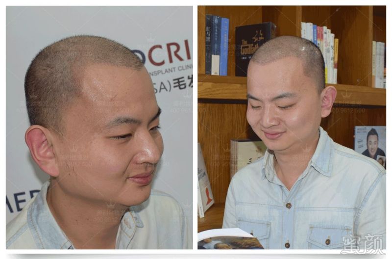 https://img.miyanlife.com/mnt/timg/180604/12232063P-11.jpg