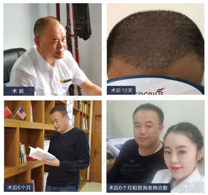 https://img.miyanlife.com/mnt/timg/180604/1223216449-13.jpg