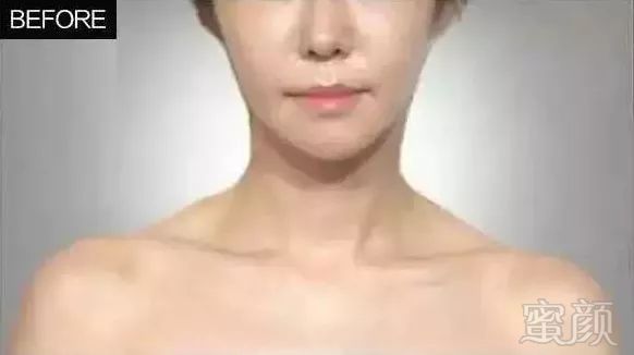 https://img.miyanlife.com/mnt/timg/180604/122J5Lc-4.jpg