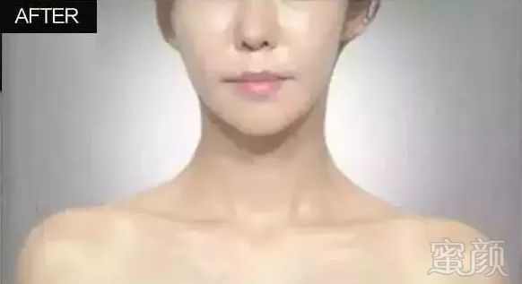 https://img.miyanlife.com/mnt/timg/180604/122J62D5-5.jpg