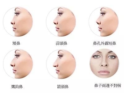 https://img.miyanlife.com/mnt/timg/180604/12422251A-3.jpg