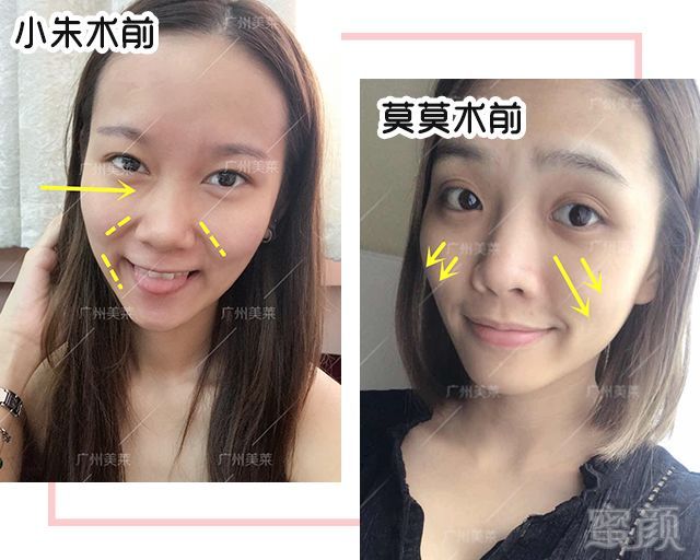 https://img.miyanlife.com/mnt/timg/180604/124HIa0-4.jpg 案例图片