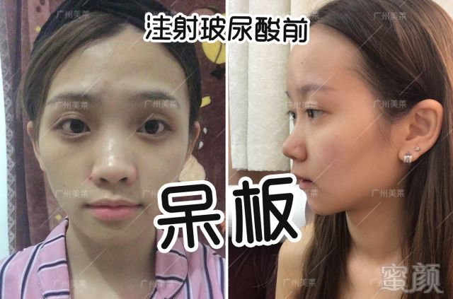 https://img.miyanlife.com/mnt/timg/180604/124Ha457-5.jpg 案例图片