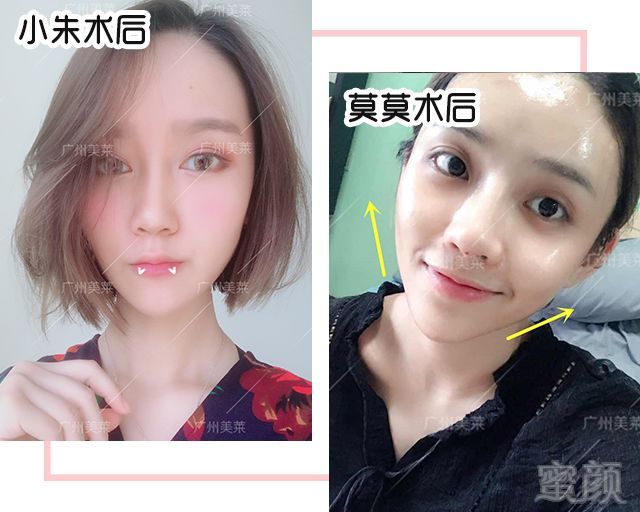 案例图片