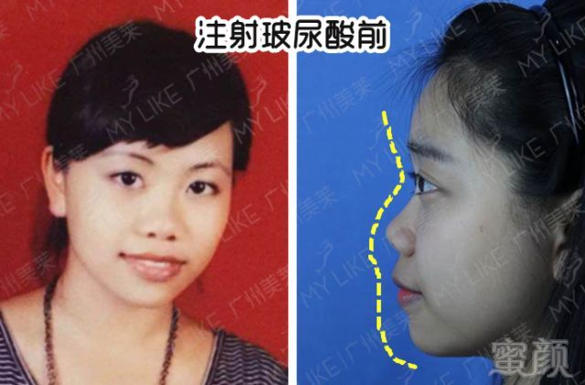 https://img.miyanlife.com/mnt/timg/180604/124I33007-8.jpg 案例图片