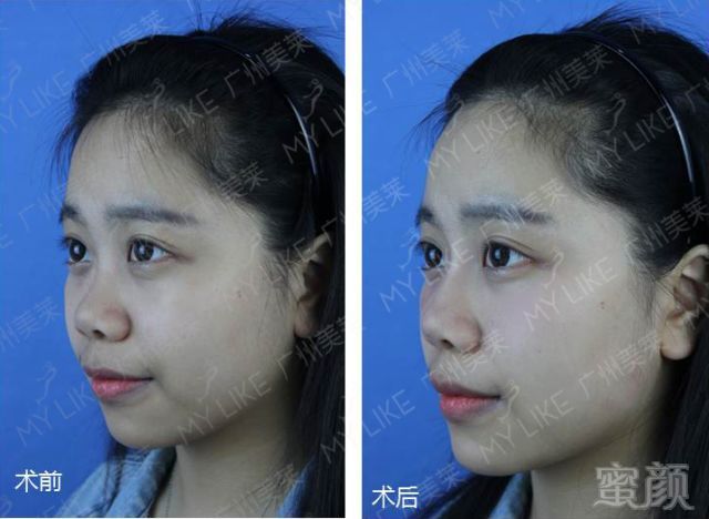 https://img.miyanlife.com/mnt/timg/180604/124I460M-9.jpg 案例图片