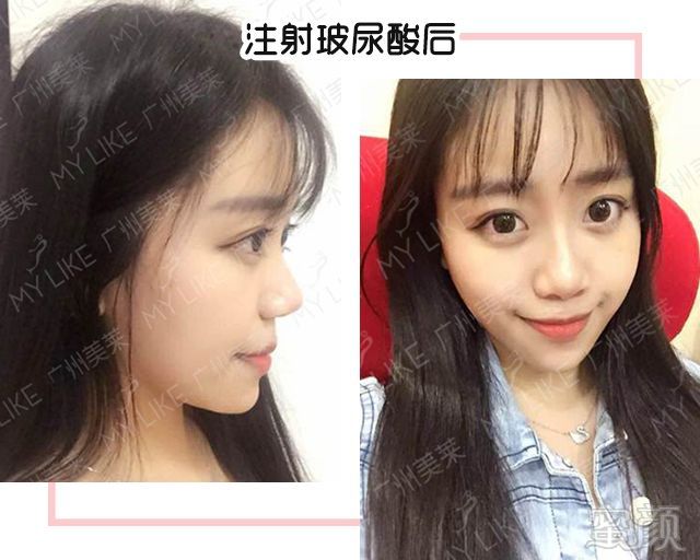 https://img.miyanlife.com/mnt/timg/180604/124I54924-10.jpg 案例图片
