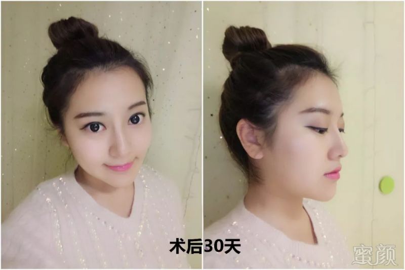 https://img.miyanlife.com/mnt/timg/180604/130T32U6-9.jpg