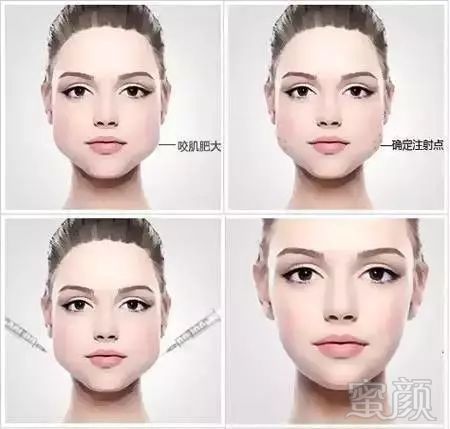 https://img.miyanlife.com/mnt/timg/180605/10104213J-8.jpg