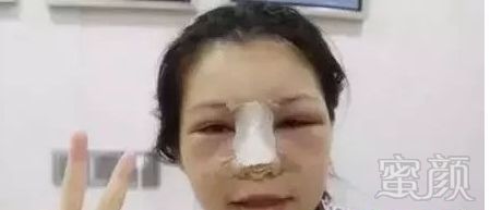 https://img.miyanlife.com/mnt/timg/180605/1054395214-3.jpg