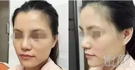 https://img.miyanlife.com/mnt/timg/180605/10543960S-4.jpg