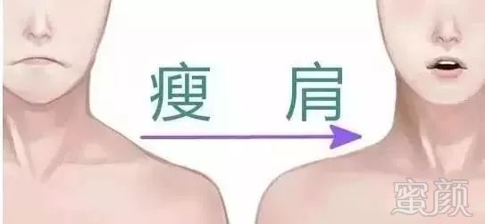 https://img.miyanlife.com/mnt/timg/180605/105A02S9-4.jpg